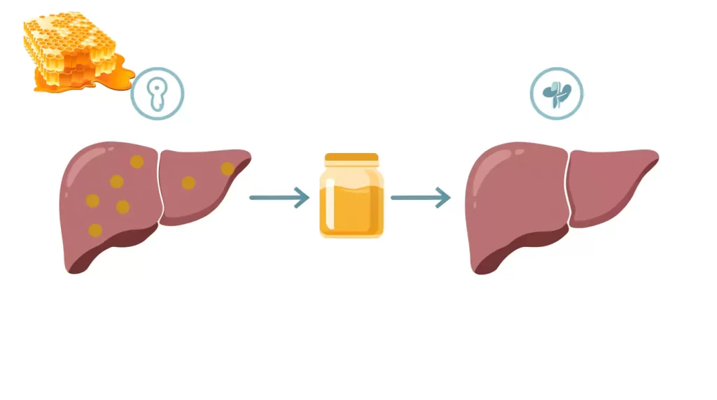 تجربیات مصرف کنندگان از عسل برای کبد چرب